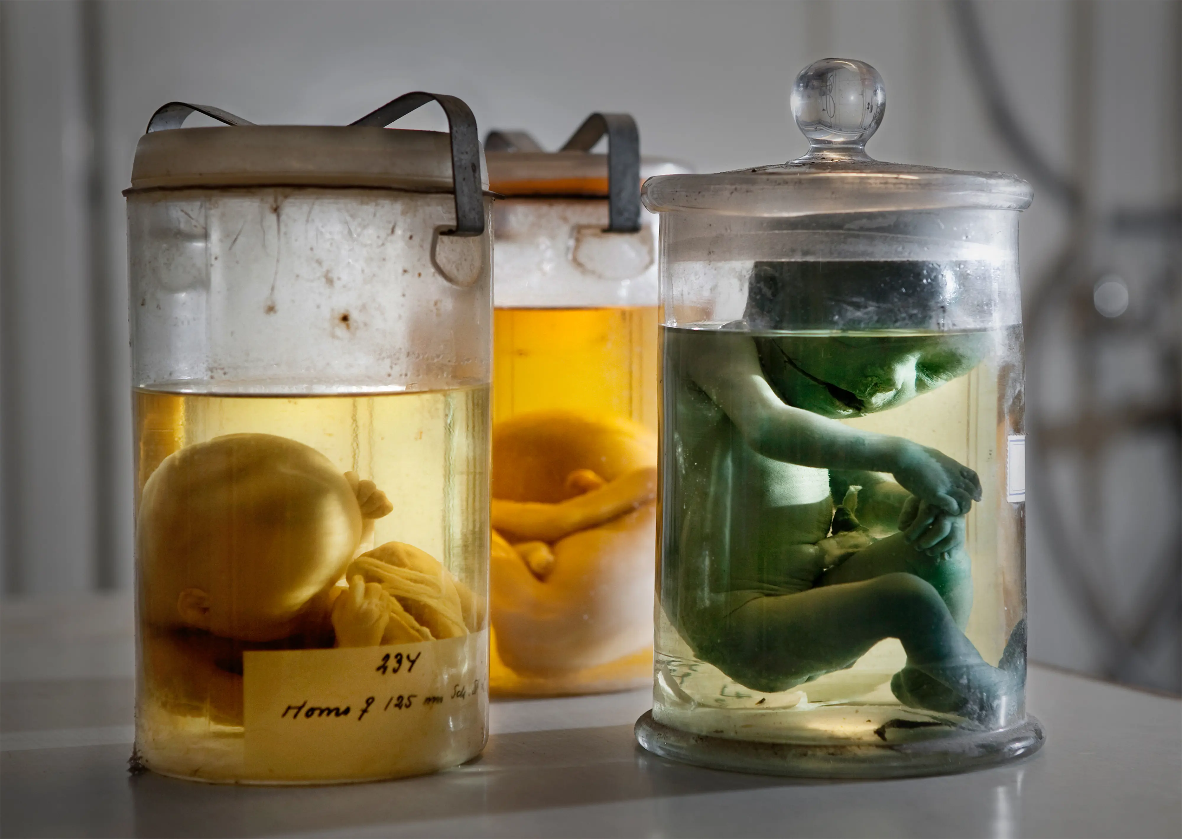 Exemplar av bevarade foster i den embryologiska samlingen vid Lunds universitet.